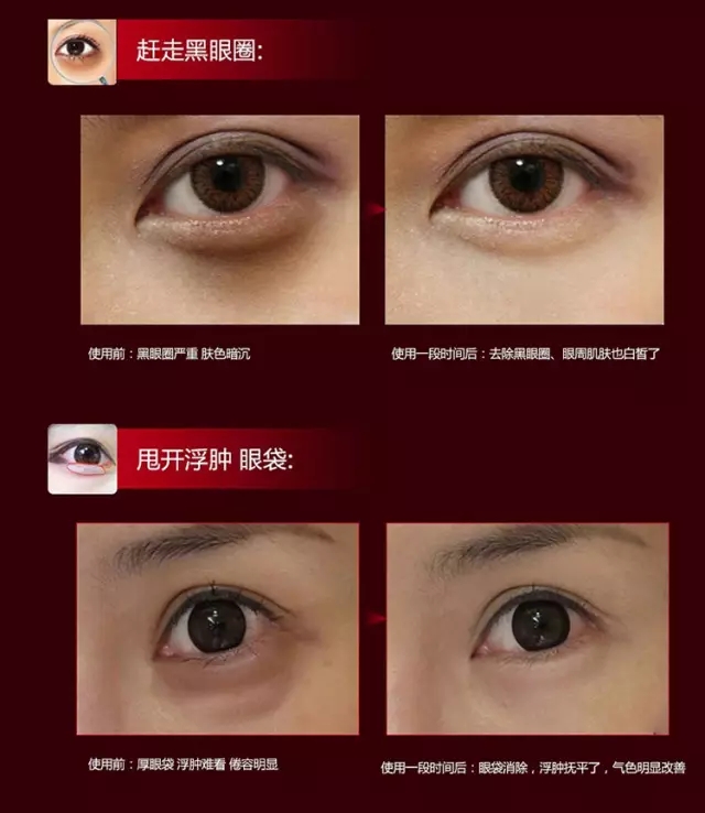 测评伊思眼霜是否真的让你回购,伊思眼霜效果怎么样