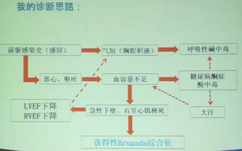 brugada三种形态的心电图,心电图查出brugada混合型严重吗