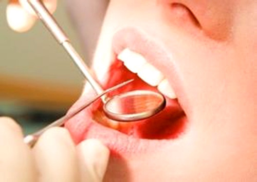 惊！根尖周病竟有这么大危害！中老年人成“重灾人群”！