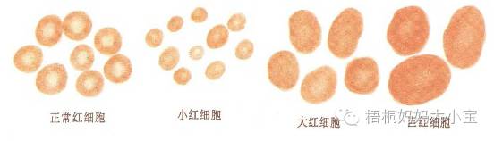 宝宝血色素正常值是多少,贫血血色素低是什么原因造成的