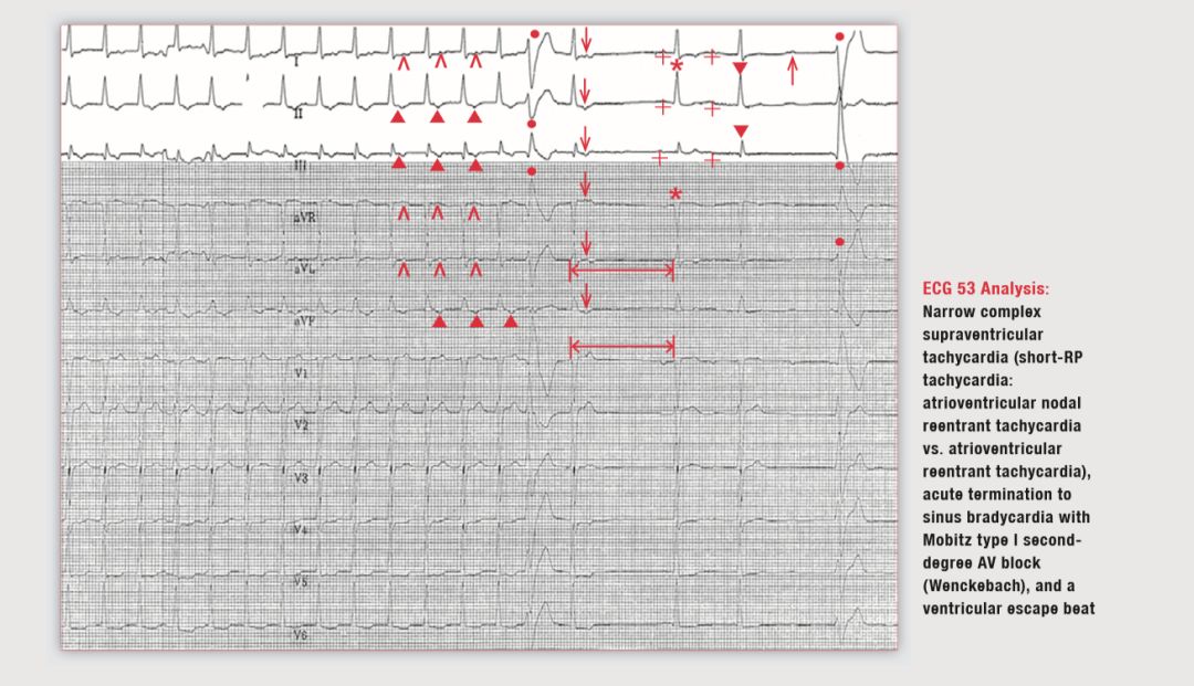读心有术2004,读心有术深度解析