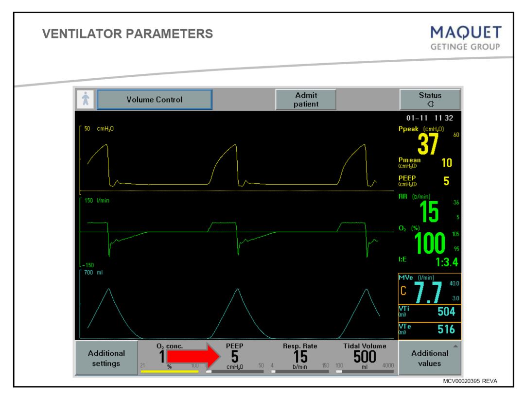 呼吸机基础知识最终版,呼吸机临床设置方法