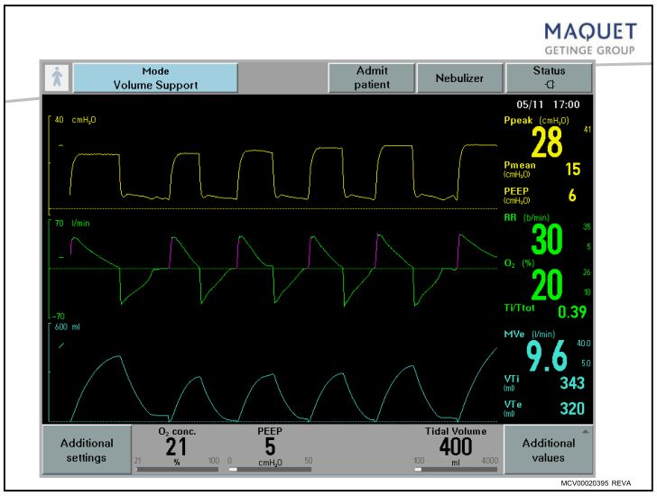 呼吸机基础知识最终版,呼吸机临床设置方法