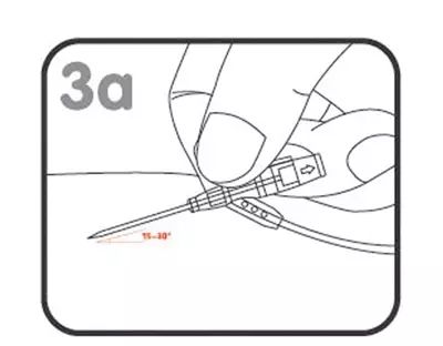 输液扎针技巧看不到血管,输液扎针的视频教程
