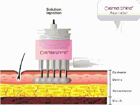 改善皮肤干燥毛孔粗大的方法,如何改善肌肤暗沉毛孔粗大的方法