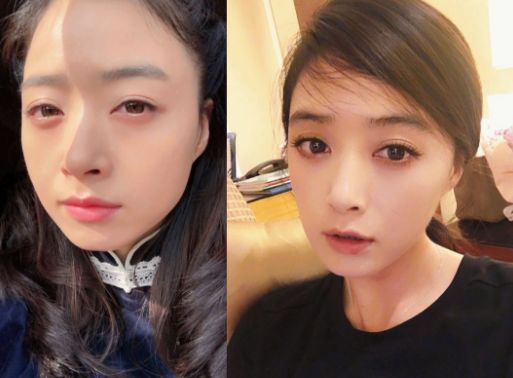 大脸怎么变小脸医美,大脸如何变巴掌脸