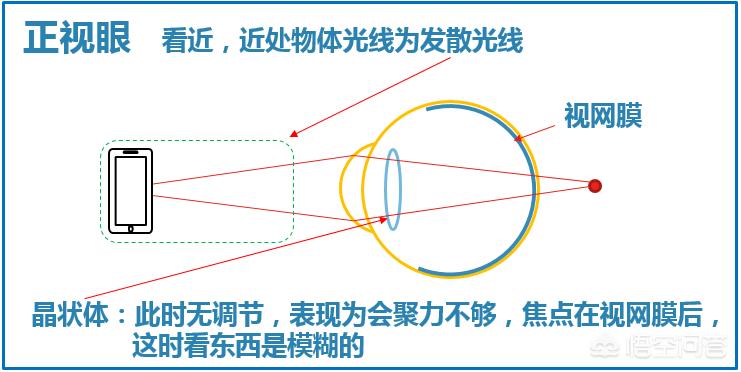 晚上如何远眺防近视,为什么远眺有助于预防近视