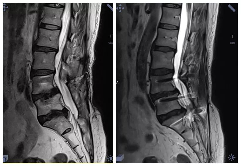目前最先进的磁共振是啥,深圳扫描速度最快的核磁共振