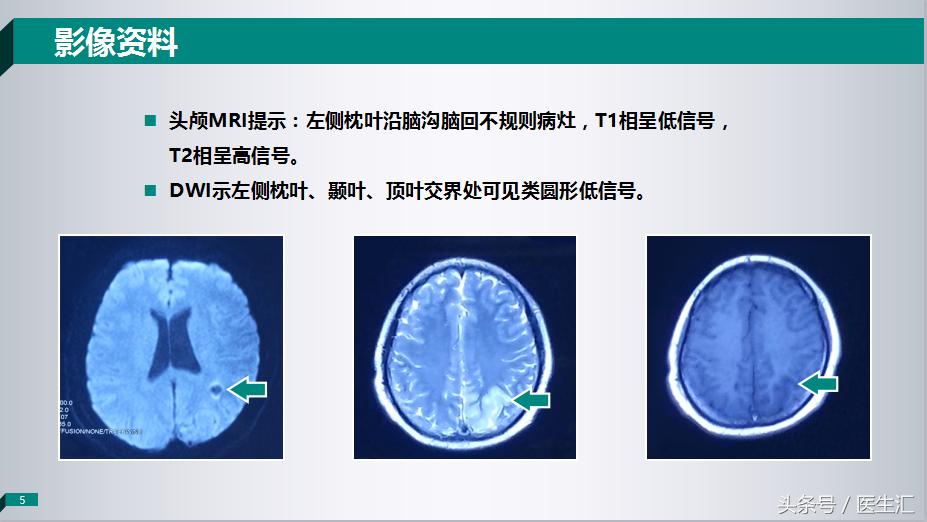 各项检查正常总感觉自己有病,轻度意识障碍是什么