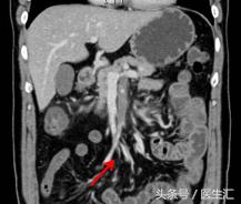 间歇性呕吐怎么回事,间歇性反酸