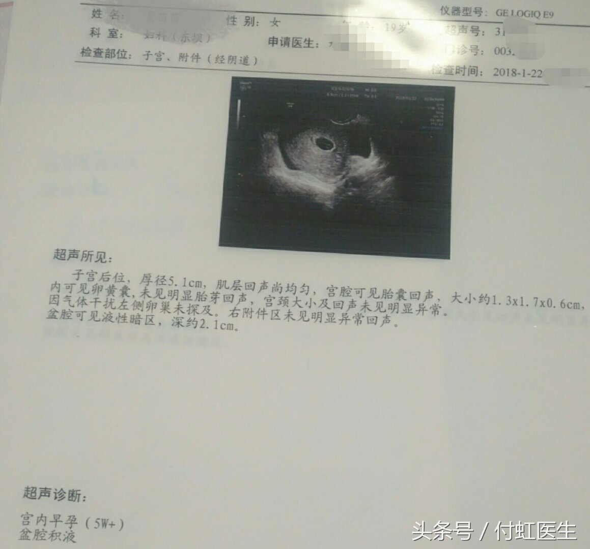 b超显示有积液是先兆流产么,刚怀孕去做b超查出盆腔积液