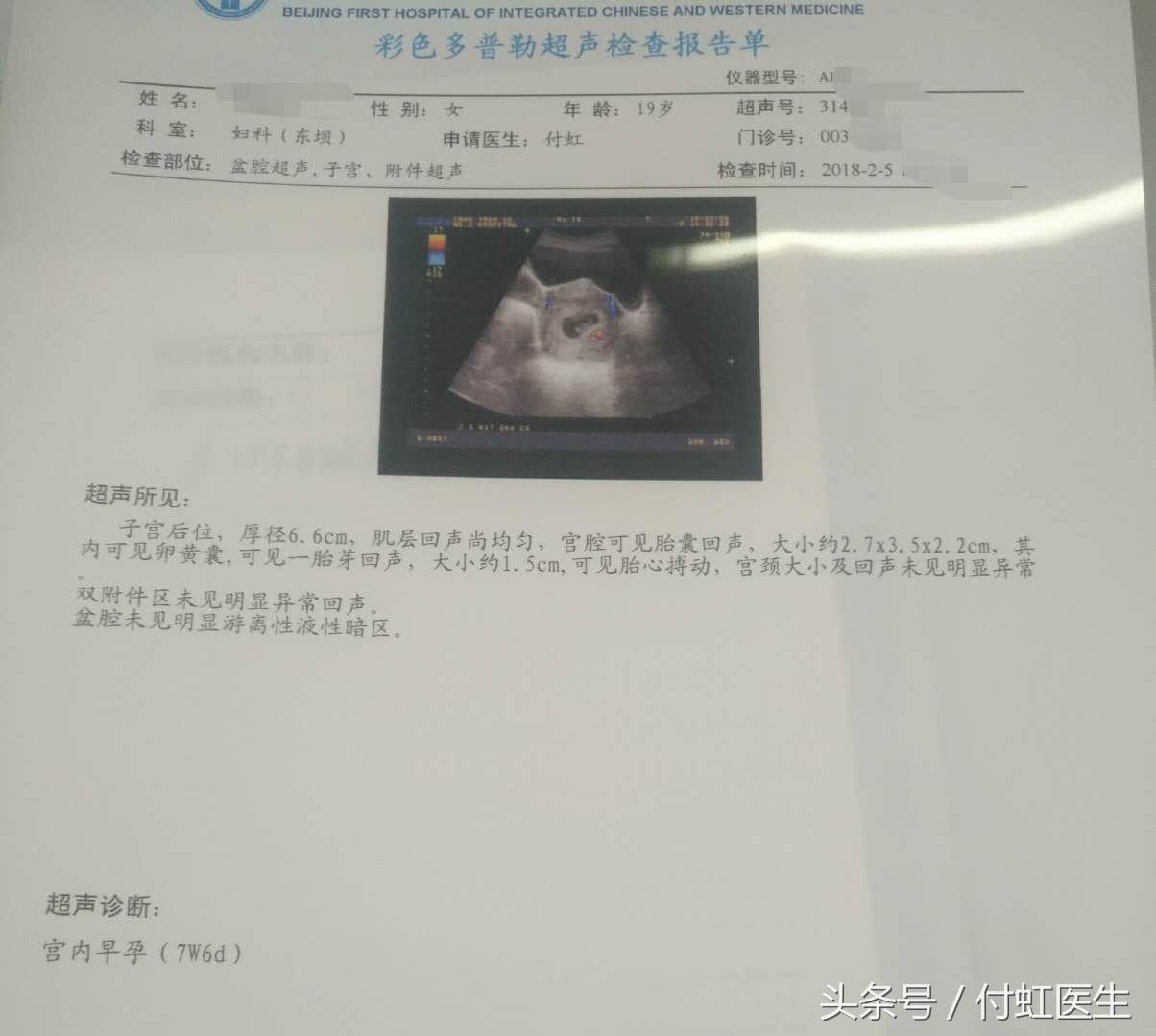 b超显示有积液是先兆流产么,刚怀孕去做b超查出盆腔积液