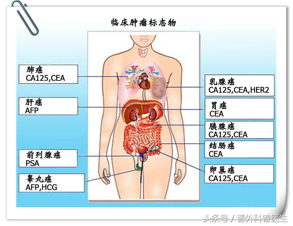 鉴别肿瘤良恶性最简单有效的方法,增强ct判断良恶性肿瘤准确率高吗