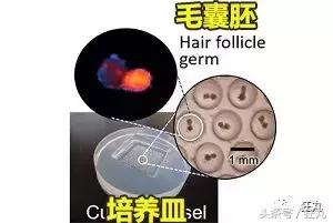 麦当劳薯条治疗脱发,麦当劳薯条掉头发