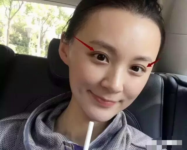 杨幂把自己的整形医生介绍给了闺蜜吗？如何越整越自然