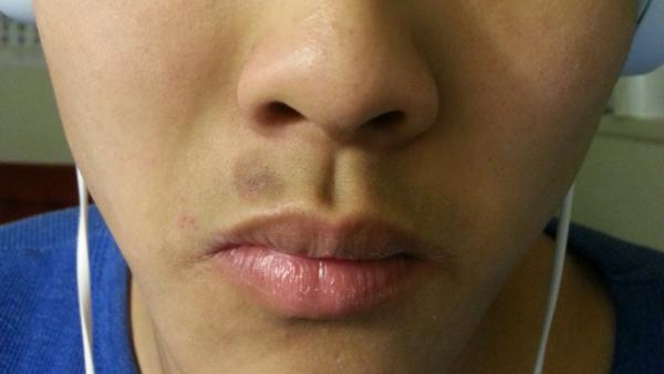 过年大鱼大肉吃什么解腻,过年大鱼大肉少不了多吃这些东西