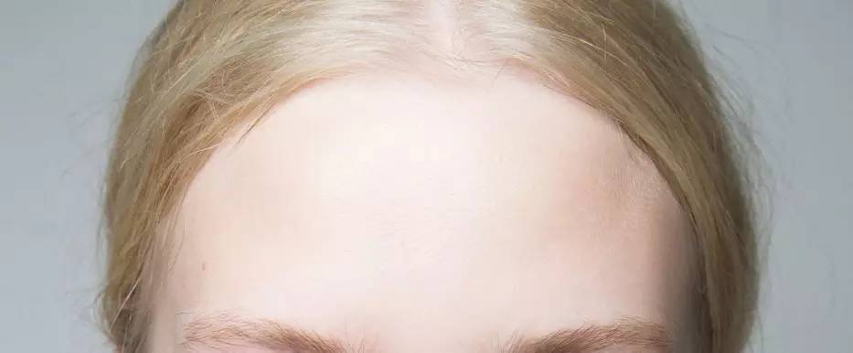 黑头为啥挤了第二天就出来了,黑头挤了两三次会变大嘛