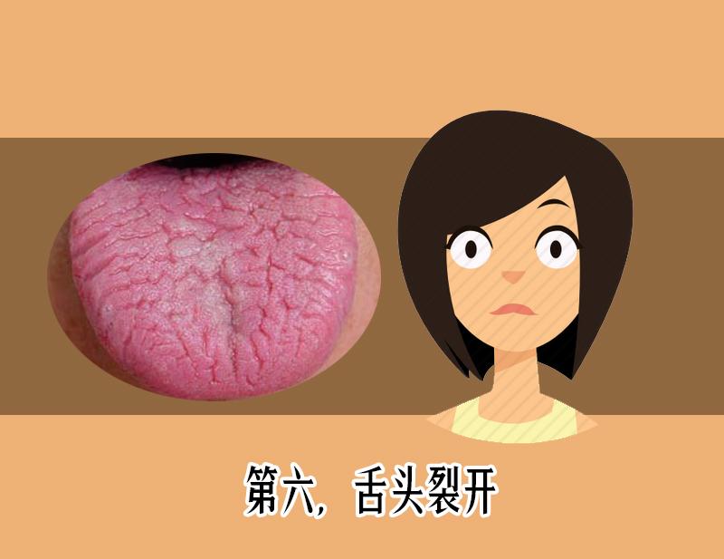 舌苔发黑辨证,舌苔发青警惕四种原因