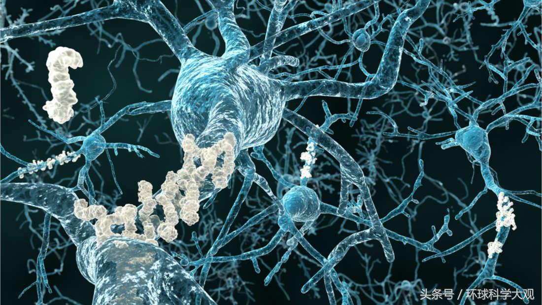 美国预防老年痴呆新药,新突破老年痴呆