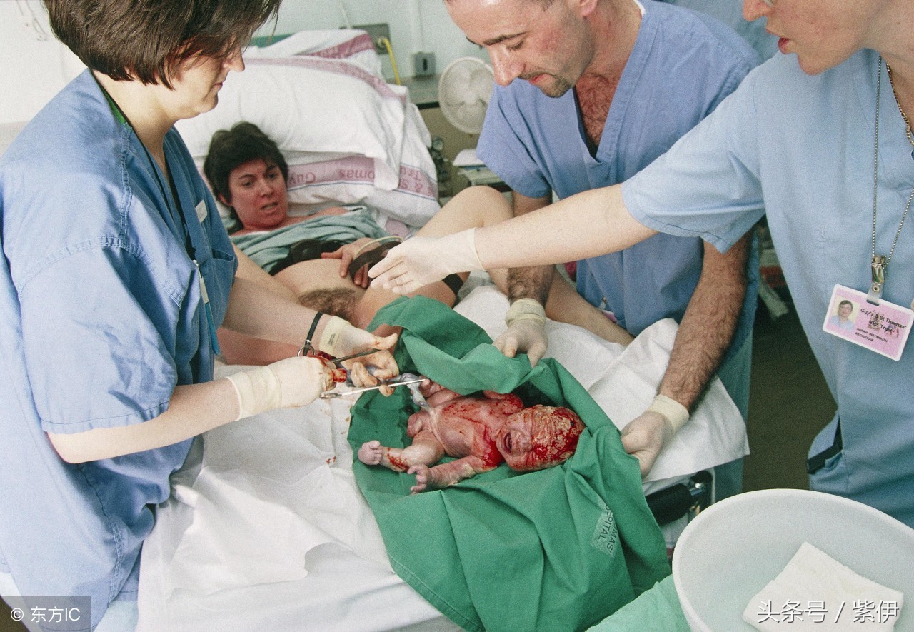 准妈妈们关于“侧切”和“撕裂”