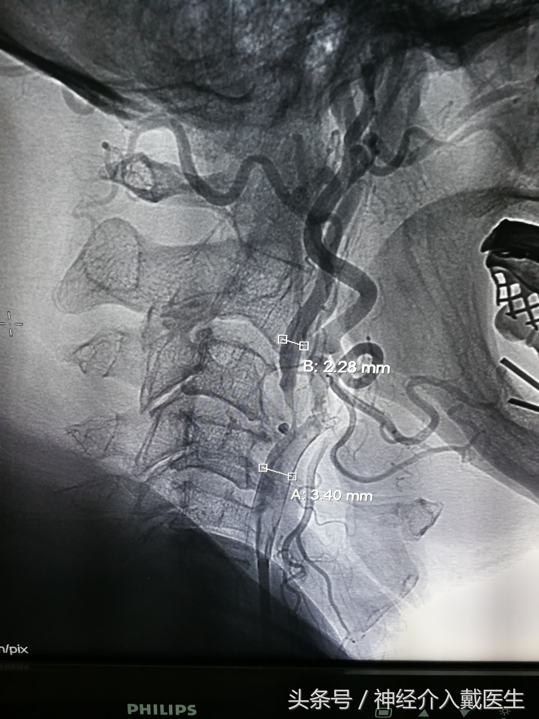 经常晕倒什么原因,经常晕倒是什么原因