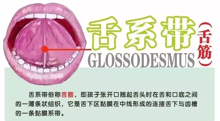 小孩说话不清楚剪舌根多久恢复,儿童说话正常舌筋有没有必要剪