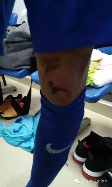 2016足协杯苏宁宏兴,武汉宏兴江苏苏宁打架