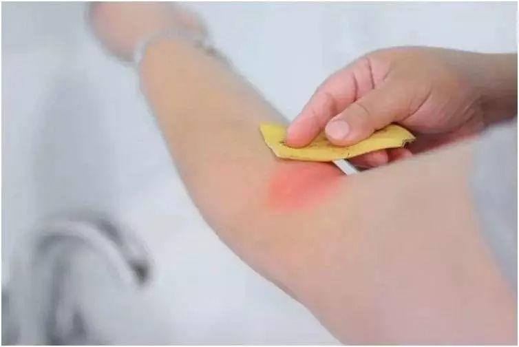 香蕉皮用处多，看过之后又省一大笔钱