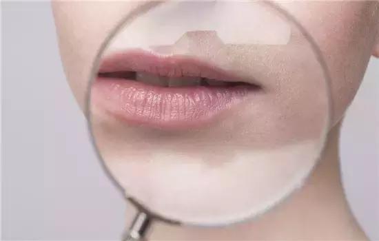 唇纹深怎样涂口红不显唇纹小妙招,唇纹怎样淡化手把手教你去唇纹