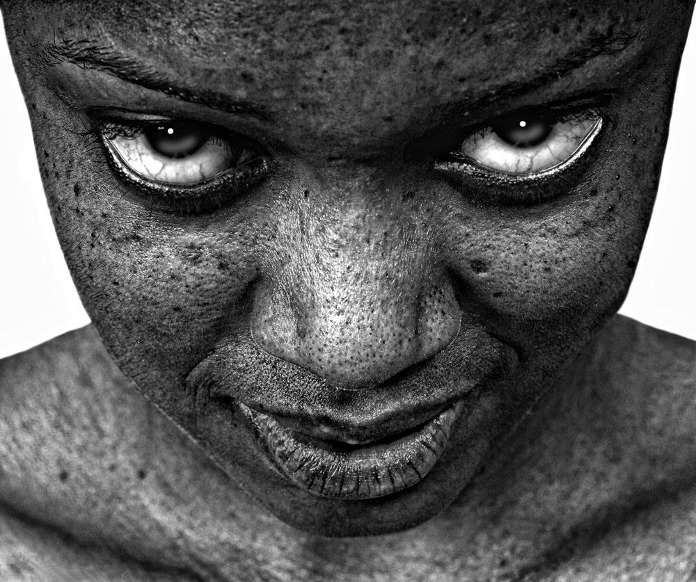 为什么用了爽肤水爆痘,为什么用爽肤水越来越干