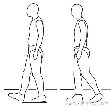 一文读懂前交叉韧带损伤,acl完整康复流程