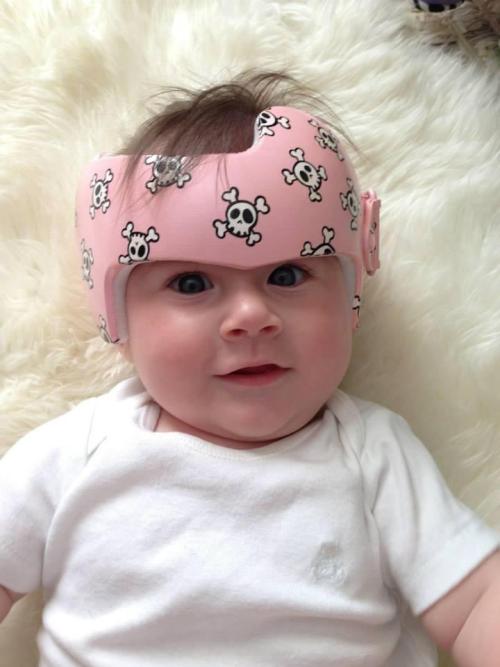 婴儿头型偏一边去了怎么纠正,宝宝头型偏尖怎么矫正