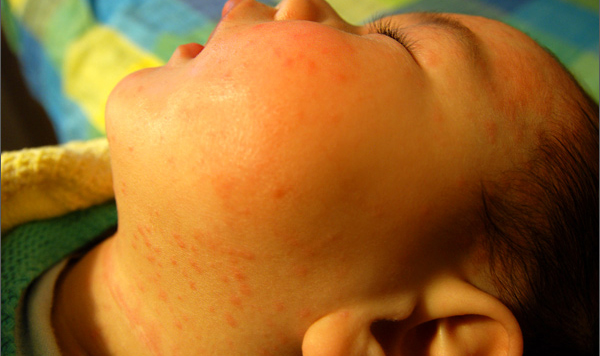 骞煎効鎬ョ柟搴斿鏂规硶,骞煎効鎬ョ柟搴斿鎺柦