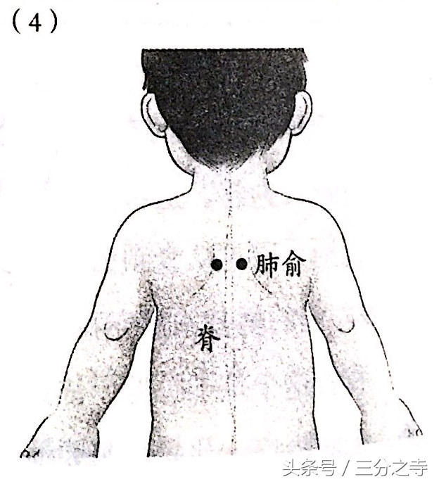 小儿休克急救的正确步骤视频,幼儿休克急救法