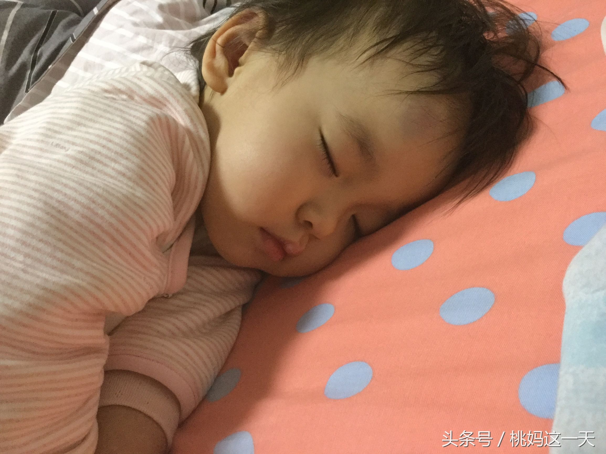 孩子脑门磕了大包最快的消肿方法,儿童头上磕个大包怎样消肿