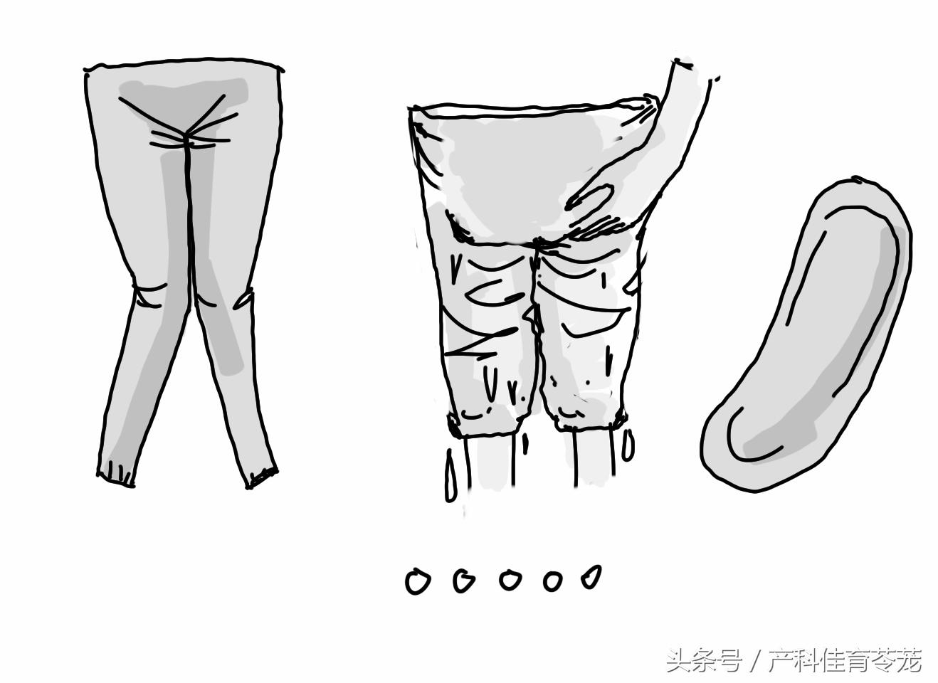 外阴瘙痒骚味重用什么药,外阴瘙痒可以自愈吗