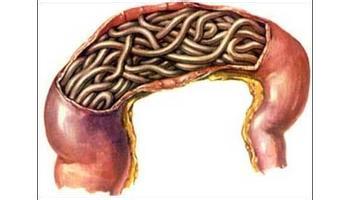 孩子肚子里生虫有何表现,怎么分辨孩子肚子里有虫