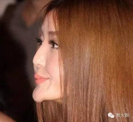 第一次整容日记,整容日记最经典的一段