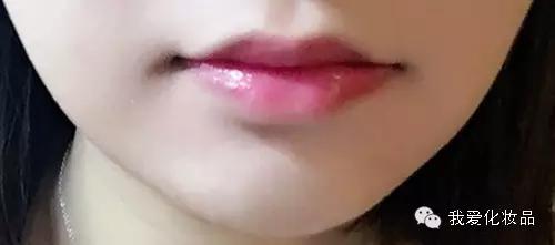 油皮痘肌适合的护肤品牌子,混油皮痘肌适用的护肤品推荐