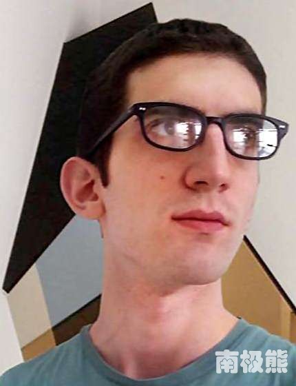 直接3d打印隐形矫正牙套,3d打印隐形牙套制作过程