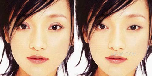 单眼皮适合割什么双眼皮,单眼皮不想割双眼皮有什么办法