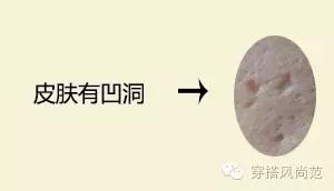 真实祛痘印最有效的方法,祛痘印最好的方法目前最有效的