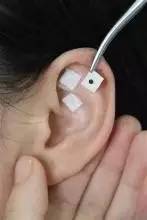 中医推拿治疗小儿近视，效果看得见！