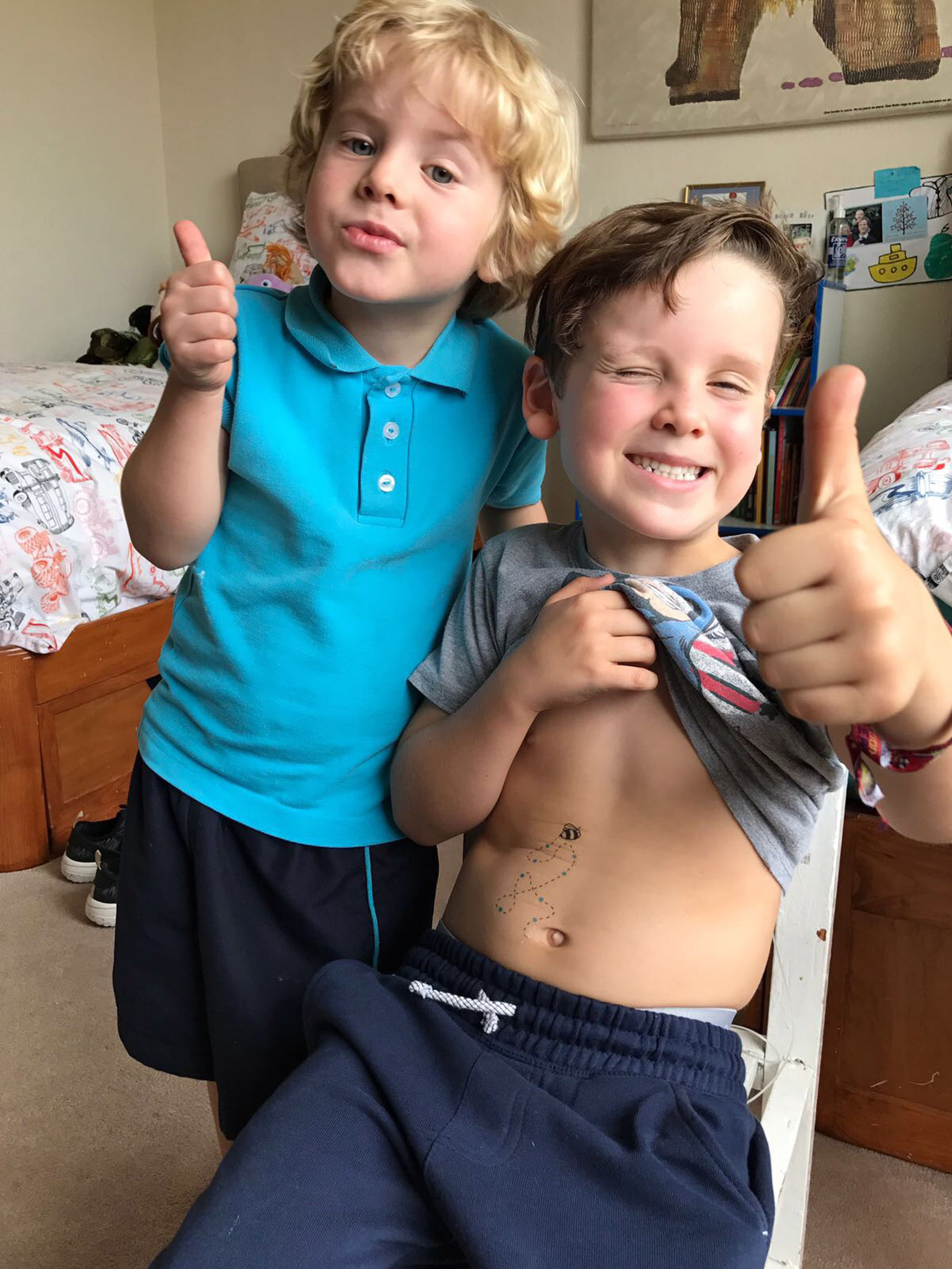 有变色的笔和纹身贴,你一定不知道这是为糖尿病儿童设计的胰岛素工具盒