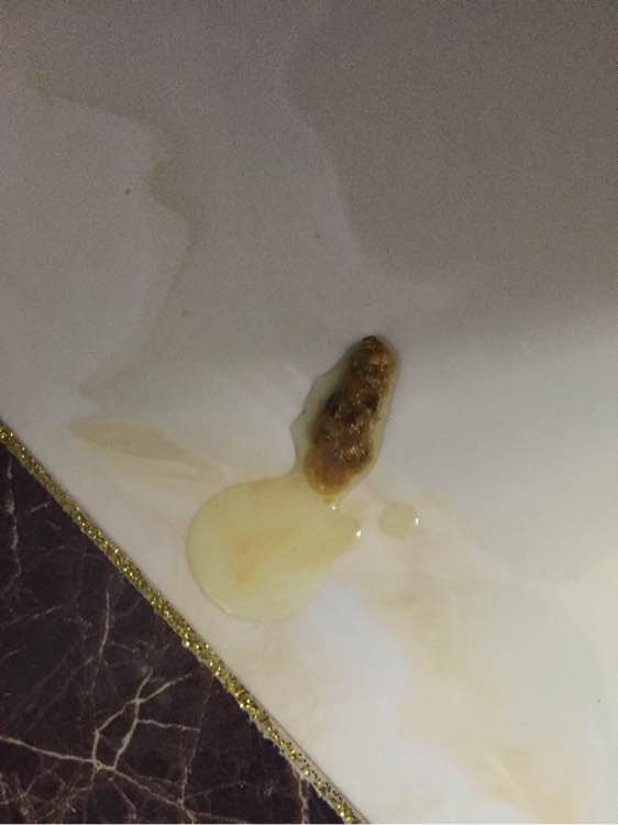 泰迪狗狗突然拉肚子呕吐,狗狗昨天拉稀今天口吐白沫