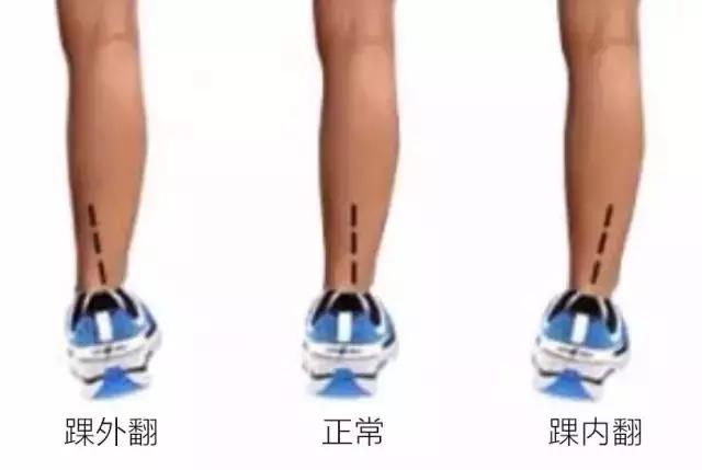选鞋不当危害,适合内翻外翻的跑鞋