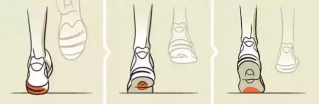 选择跑鞋内翻足和外翻足区别,亚瑟士跑鞋适合外翻还是内翻