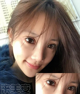 嘿医生直播,嘿医生