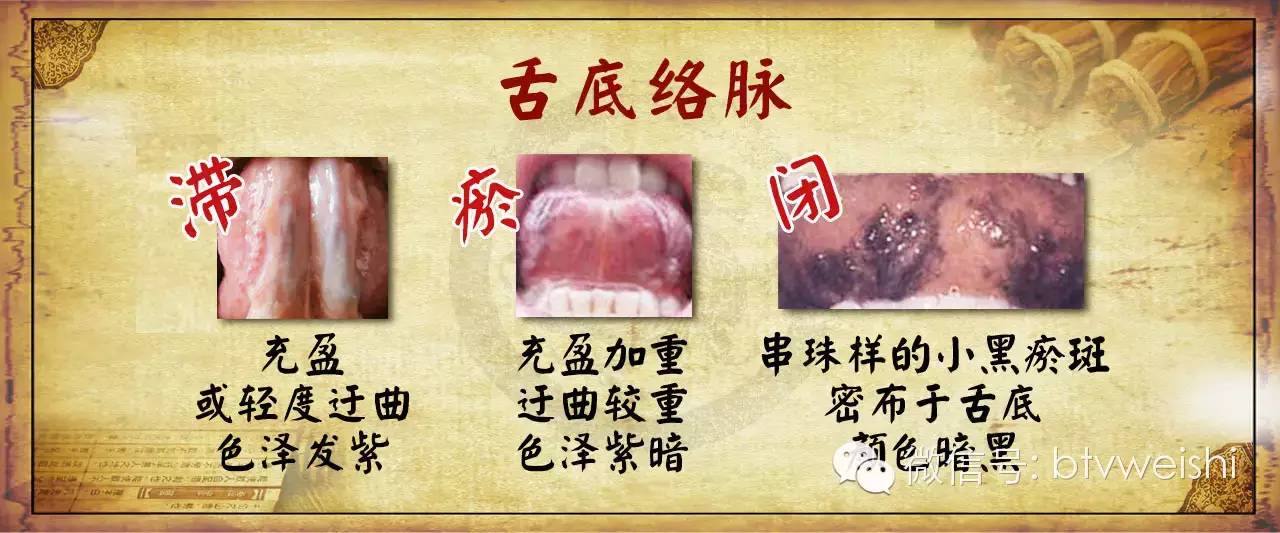 养生堂滋阴降糖方,养生堂讲的健脾补肾