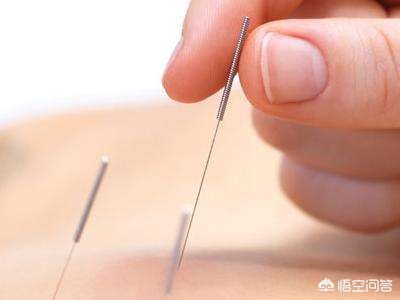 手术后怎样才能排气快,手术后咋排气快